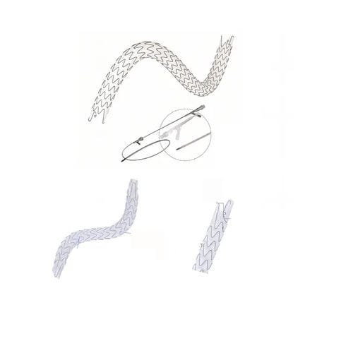 Stent ureteral - EUS series - Hunan Endovascular Device Co., Ltd. - de nitinol / de polímero / autoexpandible