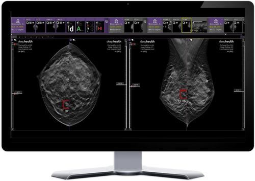 Plataforma de IA para hospitales - DeepHealth - para imágenes médicas / de aprendizaje automático / visualizador