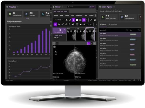 PACS con computación en la nube - Diagnostic Suite™ - DeepHealth - para imágenes médicas / procesos basados en la web / médico