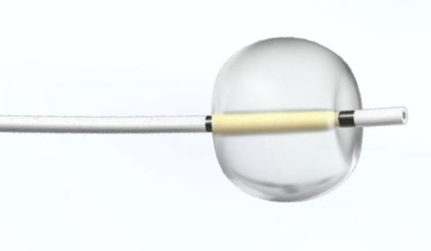 Catéter de extracción de cálculos - Focuz Medical - biliar / con balón