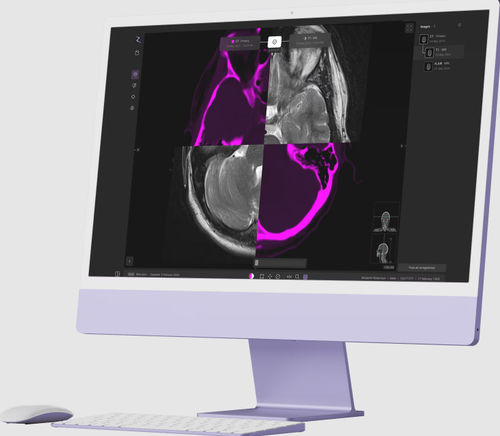 Software médico - zap-axon - ZAP Surgical Systems Inc - de diseño / de tratamiento / de planificación