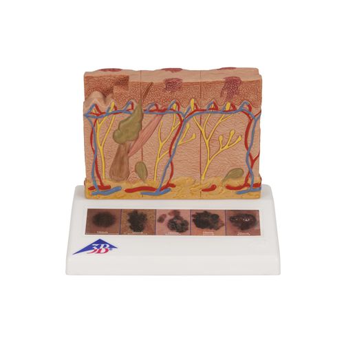 Modelo anatómico de piel - J15 - 3B Scientific   - de formación / para el cáncer
