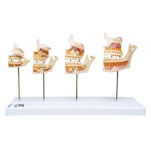 Modelo anatómico de mandíbula - D20 - 3B Scientific   - de dientes / de formación