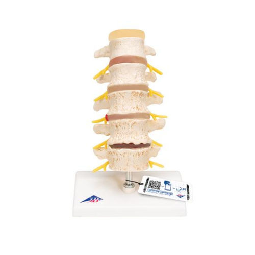 Modelo anatómico de vértebras - A795  - 3B Scientific   - de formación / de hernia / desarticulado