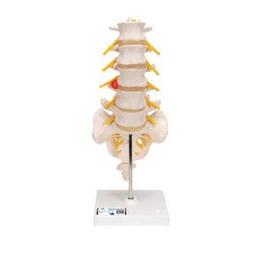Modelo anatómico de la columna vertebral lumbar - A76/5 - 3B Scientific   - de sacro / de formación