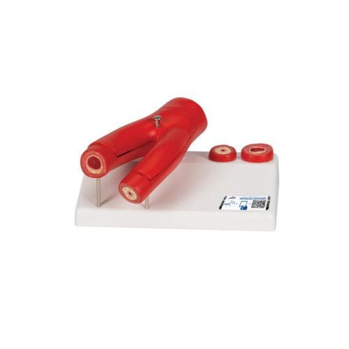 Modelo vascular de arteria - G40 - 3B Scientific   - de formación / de aterosclerosis / con vasos sanguíneos
