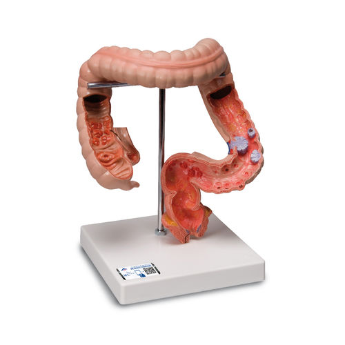 Modelo anatómico intestino grueso - K55 - 3B Scientific   - de formación