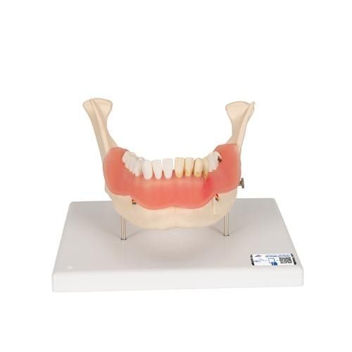Modelo anatómico de mandíbula - D26 - 3B Scientific   - de dientes / de formación