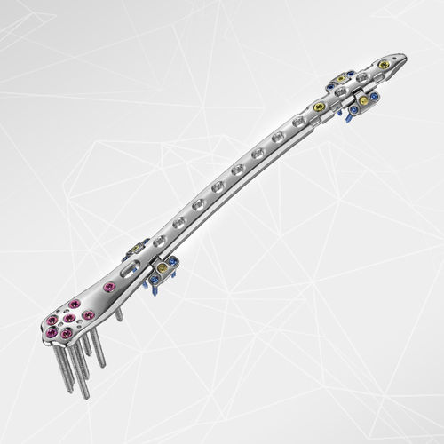 Placa de compresión para fractura femoral periprotésica - LOQTEQ®  - aap Implantate - porción distal / lateral / bloqueada