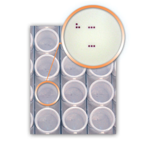 Kit de prueba para enfermermedades infecciosas - DA4270 - AID , Autoimmun Diagnostika   - HPV / virus del papiloma humano / faríngeo