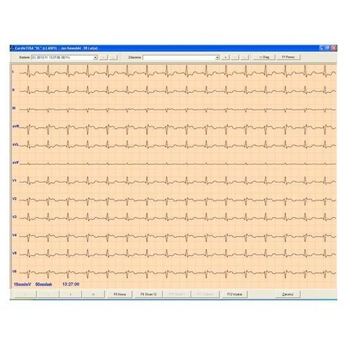 Software para electrocardiografía - CARDIOTEKA v.211SOFTHL7 - ASPEL  - visualizador / de corazón / en línea