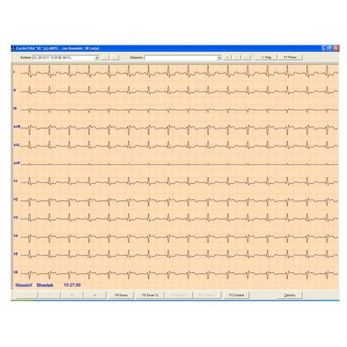 Software para electrocardiografía - CARDIOTEKA v.211SOFT - ASPEL  - de diagnóstico / de monitorización / de corazón