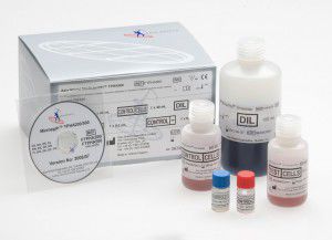 Prueba rápida de sífilis - FTPHA200 - Axis-Shield PLC  - de Treponema pallidum / de suero / por plasma