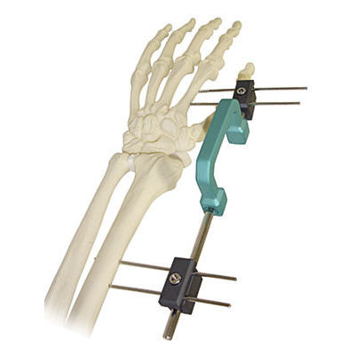 Fijador externo para muñeca - 568 - BAUMER  - tubular / para adulto
