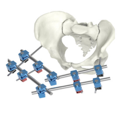 Fijador externo de pelvis - BAUMER  - tubular / para adulto / pediátrico