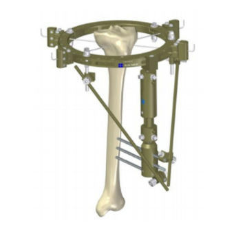 Fijador externo para tibia - 549.10 - BAUMER  - híbrido / para adulto
