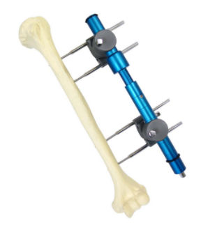 Fijador externo para húmero - 563.10 - BAUMER  - tubular / para adulto