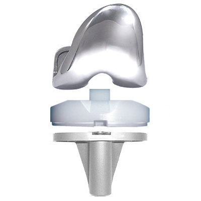 Prótesis de rodilla tricompartimental - AKS - BAUMER  - de platillo fijo / cementada