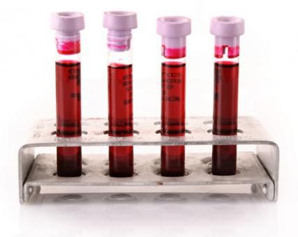 Reactivo plasma - SHK256-4G - BBI Enzymes  - para la investigación / VHB / de origen humano