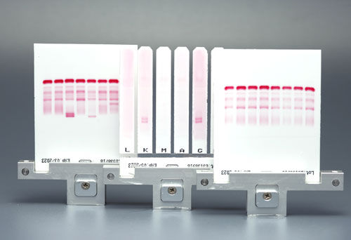 Reactivo de suero - CELL - Start Project  - antisuero / de electroforesis / de diagnóstico