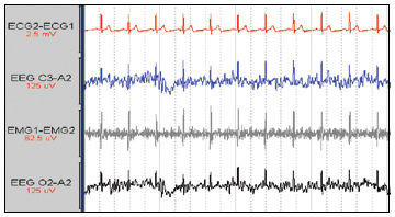Software médico - ECG Free - Compumedics - para electrocardiografía