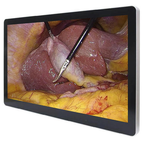 Monitor médico - ECONT-0501.7 - Contact Co. - quirúrgico / 4K / 43"
