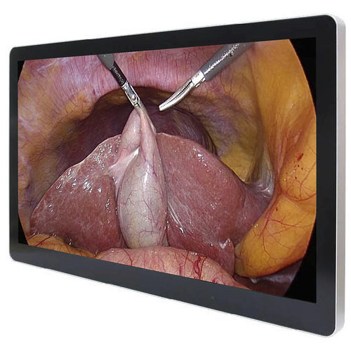 Monitor médico - ECONT-0501.3 - Contact Co. - quirúrgico / Full HD / 27"