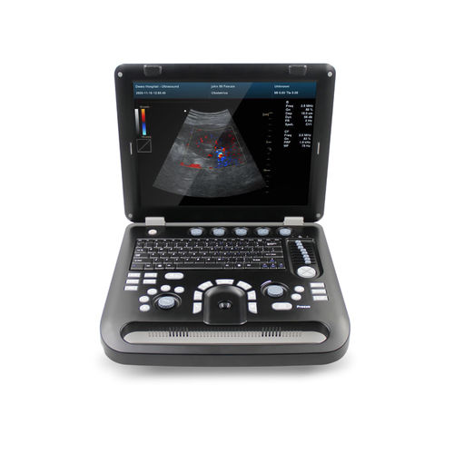 ecógrafo portátil - Contec Medical Systems