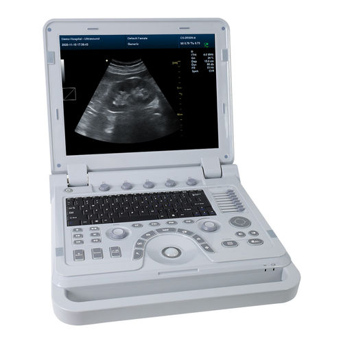 Ecógrafo veterinario portátil - CMS1700A-VET - Contec Medical Systems - multifuncional / blanco y negro / doppler-color