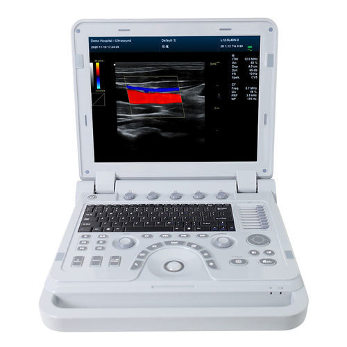 ecógrafo portátil - Contec Medical Systems