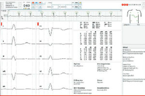 Algoritmo de diagnóstico - ECG algorithms - Corscience GmbH & Co. KG - de análisis / para ECG