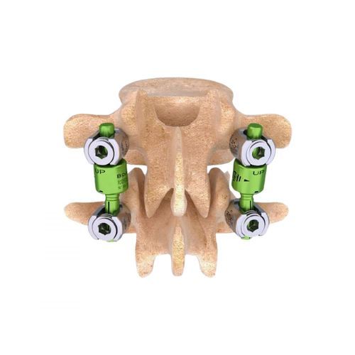 Sistema de osteosíntesis toraco-lumbo-sacro - BDYN - Cousin Biotech - vía posterior / para adulto