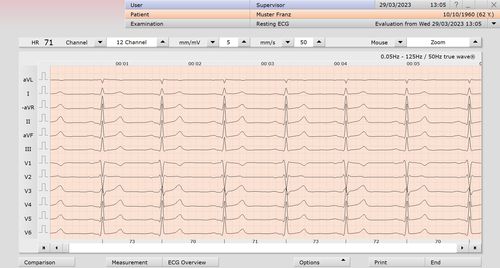 Módulo de software de análisis - custo med GmbH - de medición / de diagnóstico / para electrocardiografía