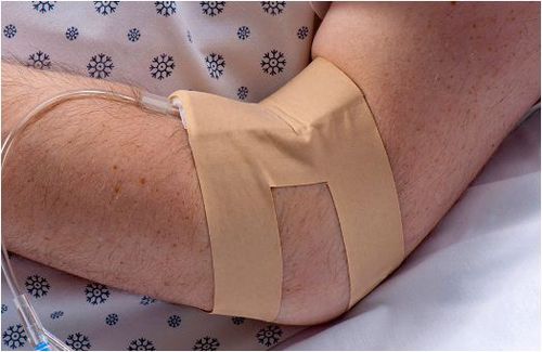 Fijador de catéter para catéter intravenoso - IV-ARMOR®  - Dale Medical Products - en brazo / adhesivo