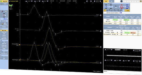 Software para EMG - DEYMED Diagnostic - de monitorización / de captura / de conductividad nerviosa