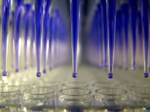 Reactivo enzima - Dia.Pro Diagnostic Bioprobes  - plasma / de diagnóstico / de IgM