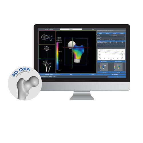 Software de visualización 3D - 3D-DXA - DMS Imaging - para osteodensitometría