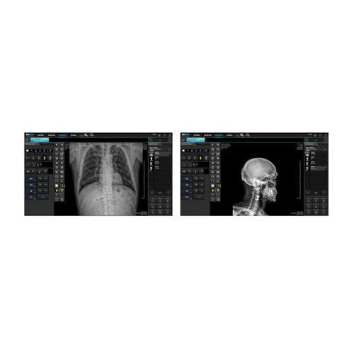 Software de visualización DICOM - DRGEM  - de impresión / de radiología