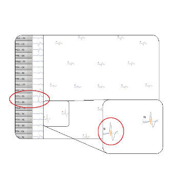 Software de visualización - Net Station 5.4  - Electrical Geodesics - de adquisición / clínico / para EEG