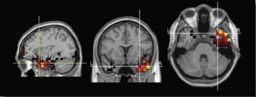 Software de visualización - GeoSource 2.0 - Electrical Geodesics - médico / para EEG