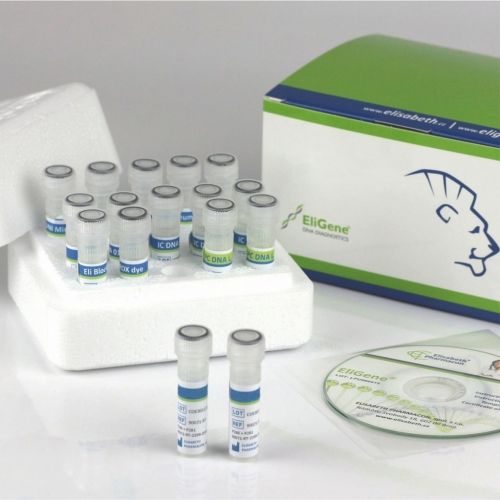 Kit de prueba para COVID-19 - 90077-RT-A500 - Elisabeth Pharmacon spol  - SARS-COV-2 / clínico / de suero