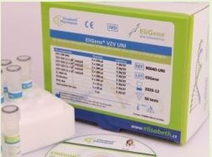 Kit de prueba de encefalitis - EliGene® TBEV LC  - Elisabeth Pharmacon spol  - para la investigación / para virus / clínico