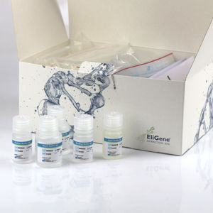 Kit de reactivos en solución - EliGene® - Elisabeth Pharmacon spol  - clínico / para muestras de saliva / para extracción de ADN