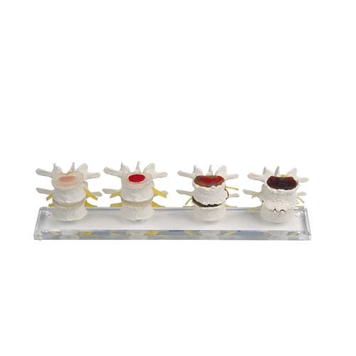Modelo anatómico de vértebras - 7577 - Erler-Zimmer - de formación / flexible / de kit