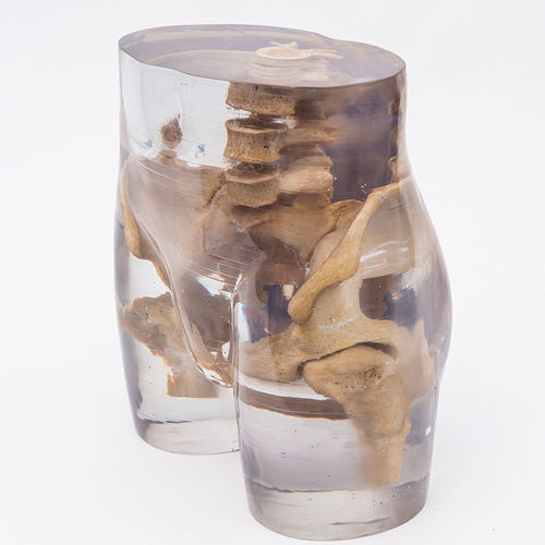 Fantoma de prueba para radiología - 7240 - Erler-Zimmer - de pelvis