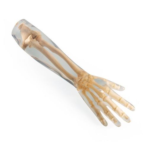 Fantoma de prueba para radiología - 7220 - Erler-Zimmer - de brazo