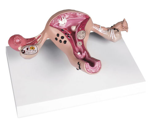 Modelo anatómico cervical - L262 - Erler-Zimmer - de útero / uterino / de cuello uterino
