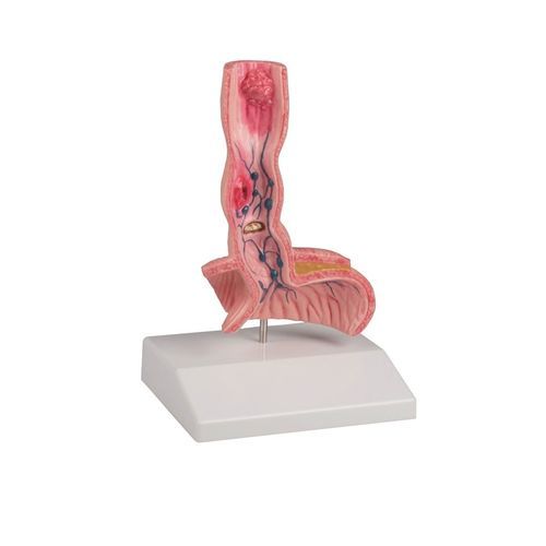 Modelo anatómico de esófago - K218 - Erler-Zimmer