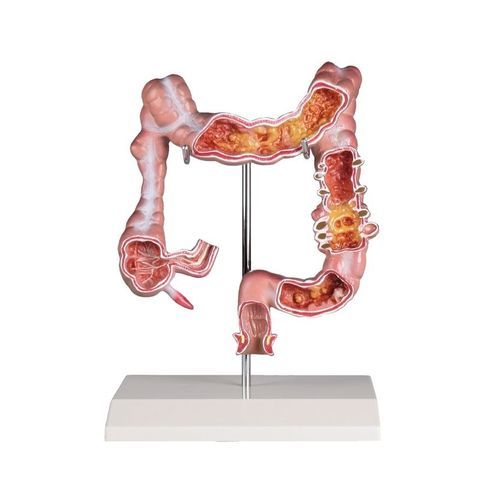 Modelo anatómico de colon - K285 - Erler-Zimmer - de formación