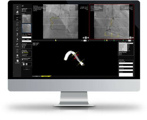Software de análisis - CAAS WORKSTATION - Esaote - de visualización / de angiografía